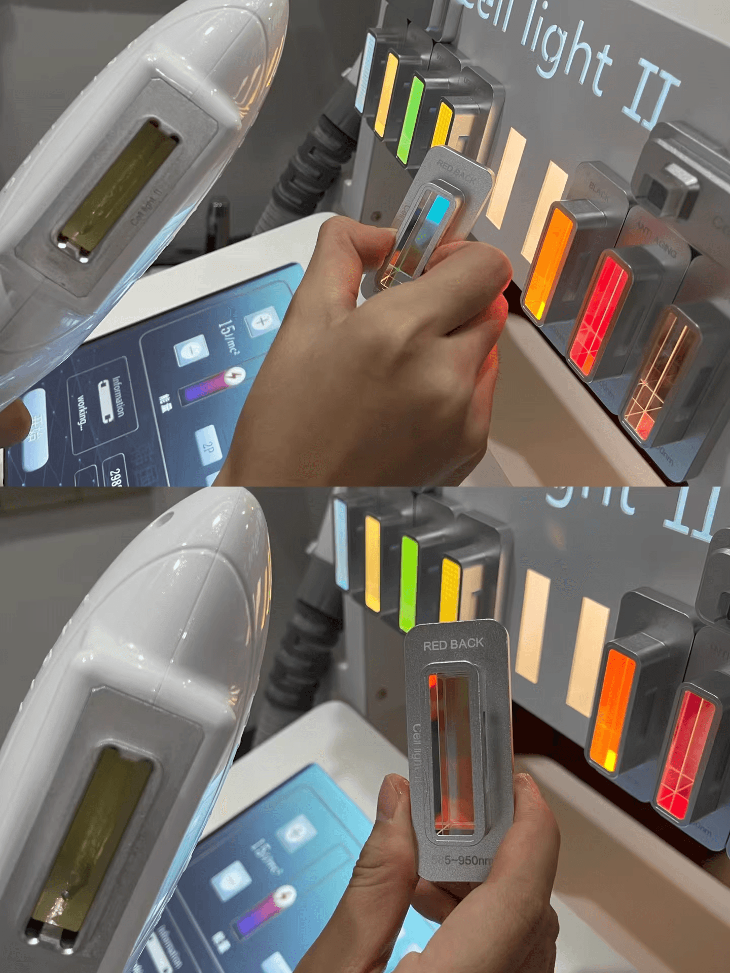 Cell Light II 細胞光治療前後對比案例 3