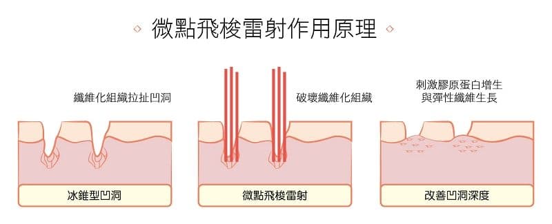 CO2飛梭雷射針對各類疤痕療程前後對比圖