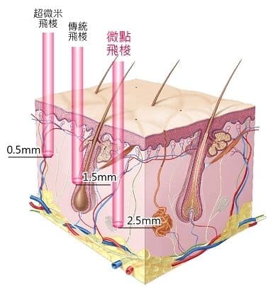 CO2飛梭雷射針對疣及痣病灶治療前後對比圖