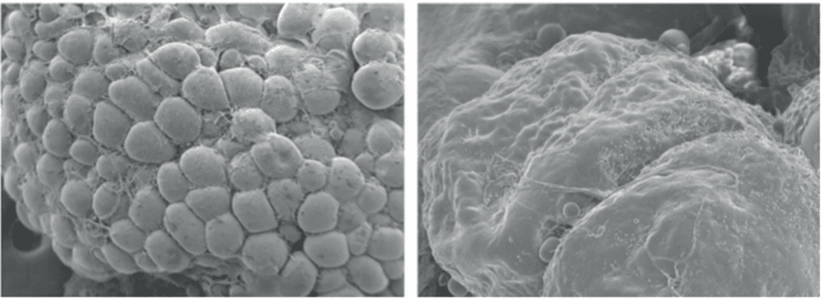 InMode 鑽石超塑作用原理圖二